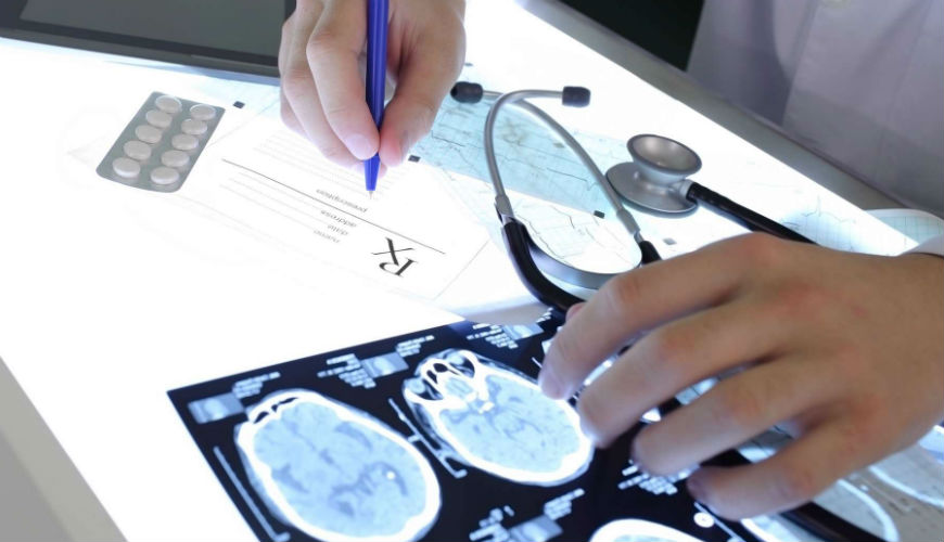 Epilepsie : création d’un cerveau virtuel par des chercheurs français