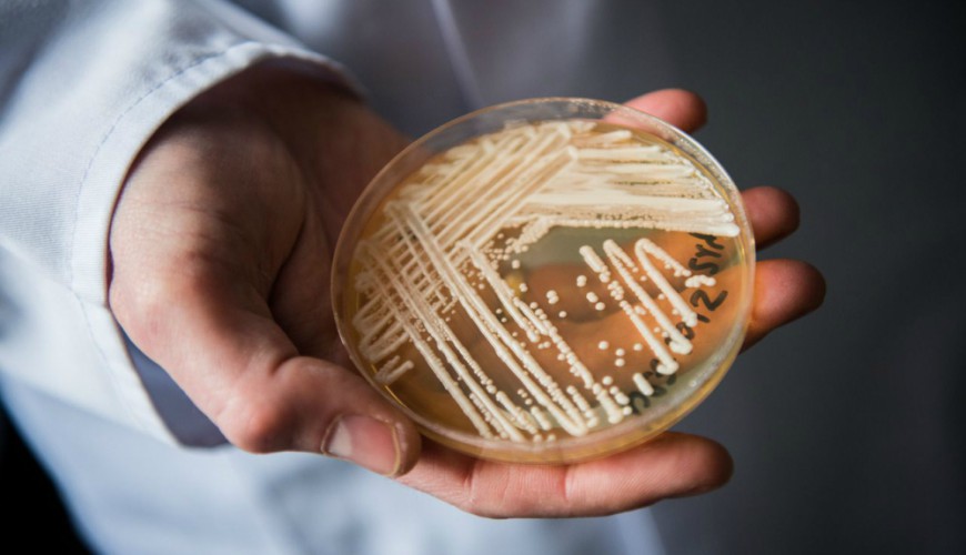 "Candida auris" : le champignon tueur qui menace le monde
