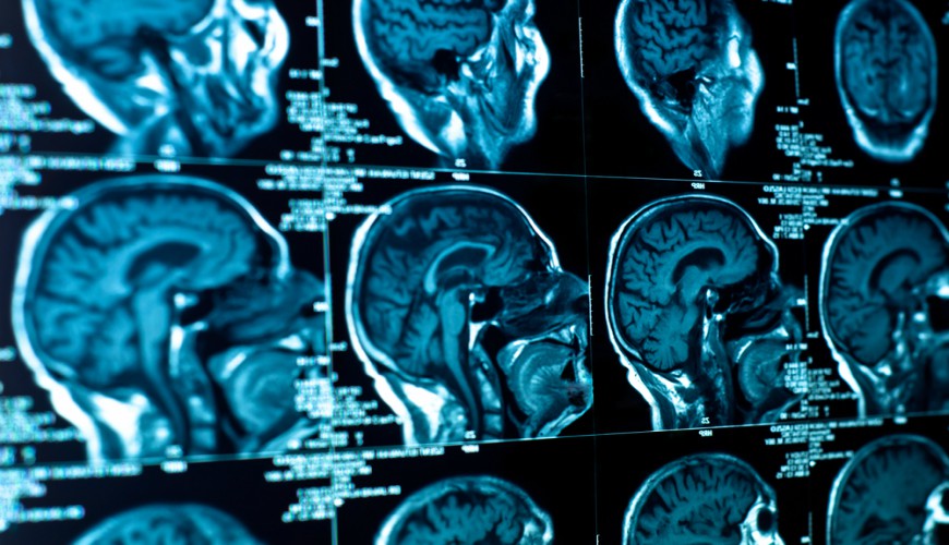 Un jeune meurt suite à une infestation de ténia dans son cerveau