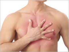 Infarctus du myocarde