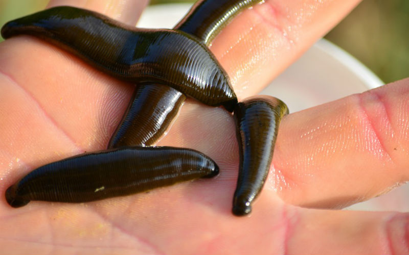 Cas rare: sangsue de 6 cm au niveau de la glotte d’une fillette Marocaine