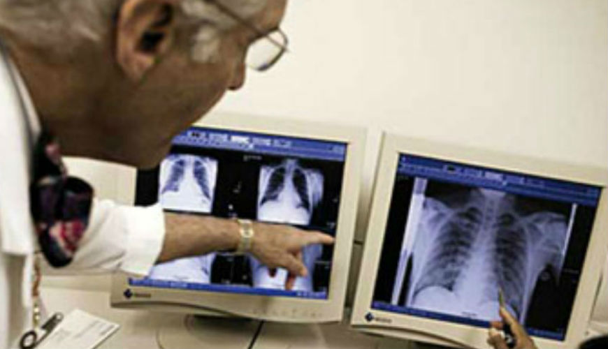 Maroc : la Tuberculose multirésistante coûte cher à la société