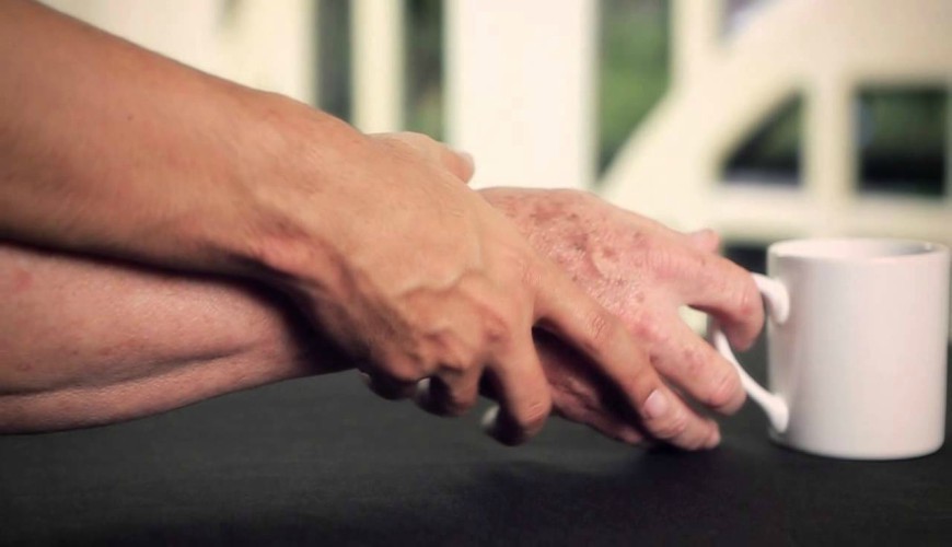 Parkinson: plus de 50.000 cas au Maroc