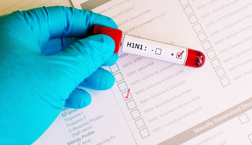 Deux cas de grippe "H1N1" à Casablanca et Mohammedia