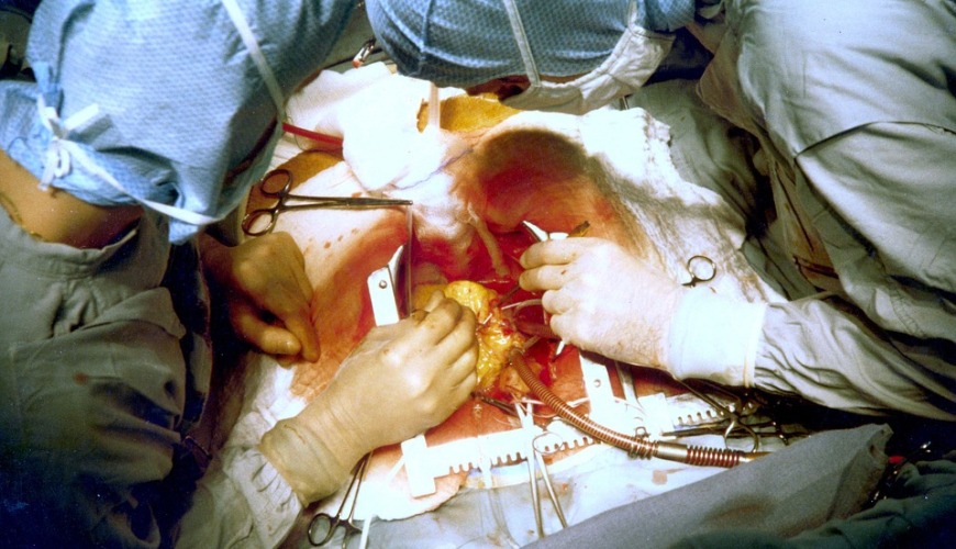 Les cardiopathies coronariennes