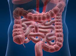 Cancer colorectal