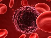 Lymphome non hodgkinien