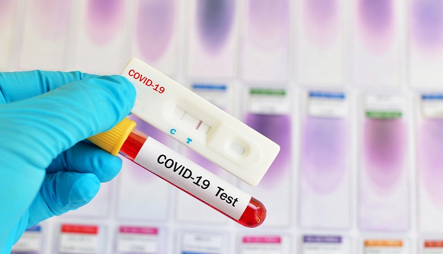 Coronavirus : le dépistage bientôt réalisés en pharmacie