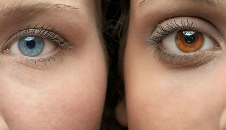 Changer la couleur des yeux, c'est enfin possible au Maroc